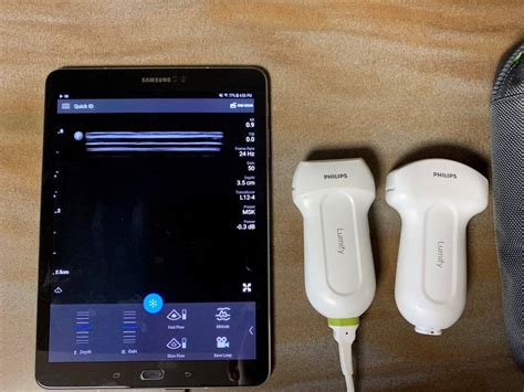 Philips Lumify Ultrasound Review - Sports Medicine Review