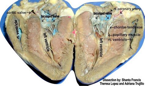 Right Ventricle Labeled