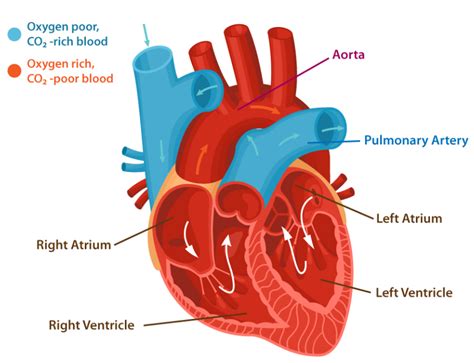 Transposition of the great arteries