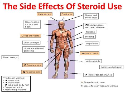 68 best images about Myositis Treatments on Pinterest | Pills, Facts about and Rheumatoid arthritis