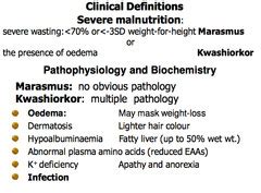 Kwashiorkor & Marasmus (4) flashcards | Quizlet