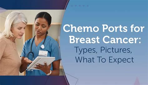 Chemo Ports for Breast Cancer: Types, Pictures, What To Expect | MyBCTeam