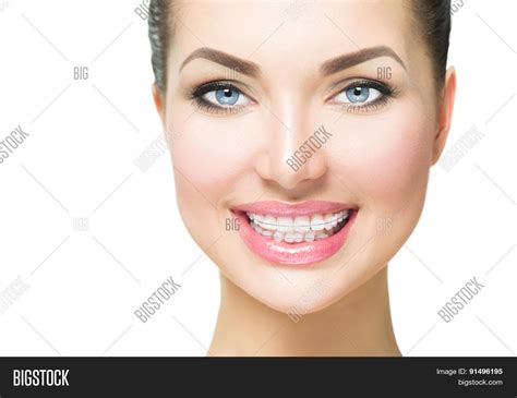 Braces. Beautiful Image & Photo (Free Trial) | Bigstock