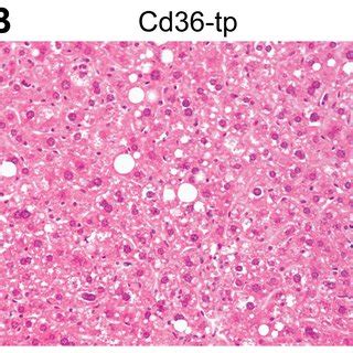 Foamy Kupffer cells. CD68 staining of Kupffer cells in liver of Wt-tp ...