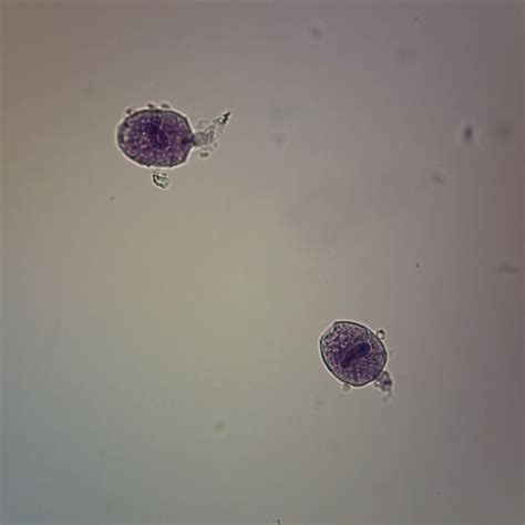 Didinium, w.m. Microscope Slide | Carolina Biological Supply