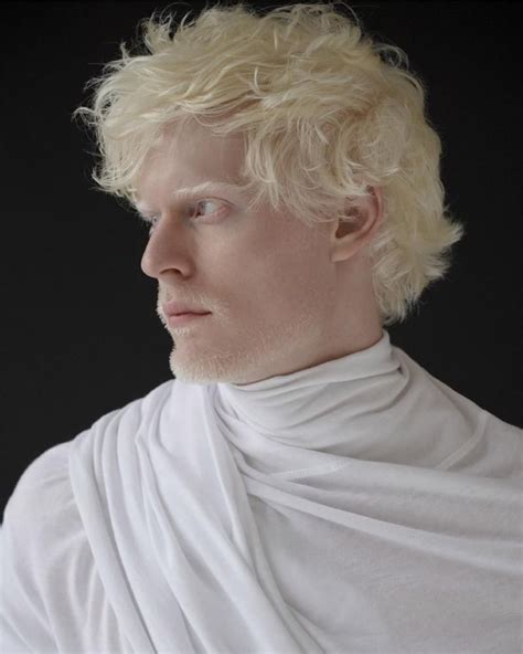 White Out (Schön Magazine) | Albino model, Albino human, Stephen thompson