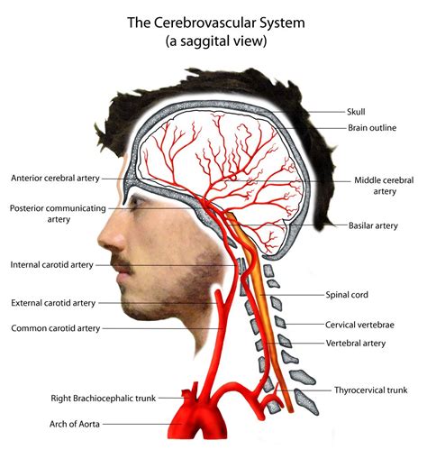 Pathophysiology | Arteries anatomy, Carotid artery, Vertebral artery