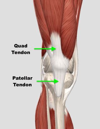 Patella & Quadriceps Tendinopathies — Brookvale Physio | HPRS Physio