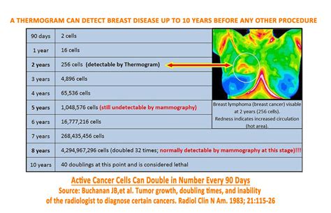 Thermography: What You Need to Know – The Health Dimension