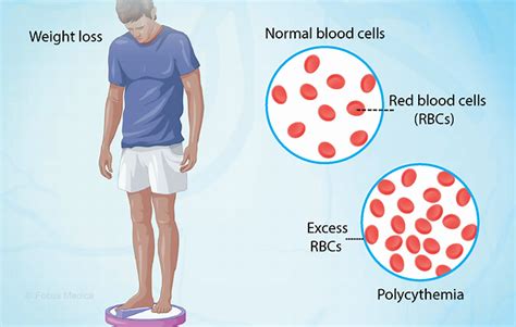 Health Condition : Symptoms, Causes, Treatment and More