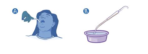 Oropharyngeal suctioning: Clinical skills notes | Osmosis