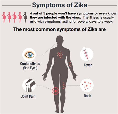 Zika virus infection history and symptoms - wikidoc