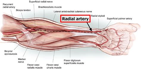 Radial Artery - Location in the Arm for Radial Artery Catheterization