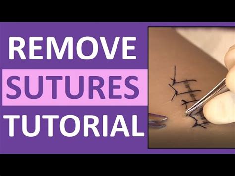 Suture Removal Nursing Skill | How to Remove Surgical Sutures (Stitches ...