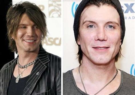 John Rzeznik Plastic Surgery: Nose Job, Facelift, Botox