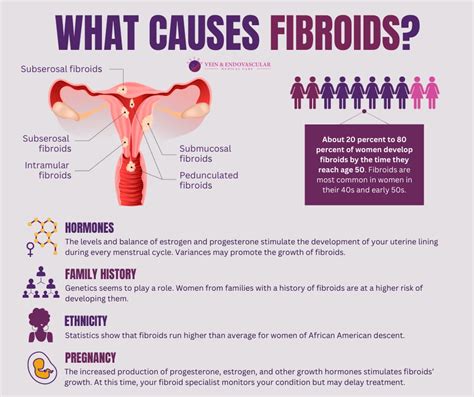 Fibroids Causes - Vein & Endovascular Medical Care