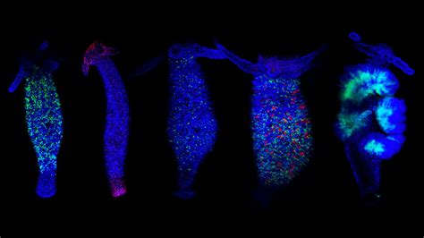 Mapping how hydra regrow cells may demystify regeneration | Science News