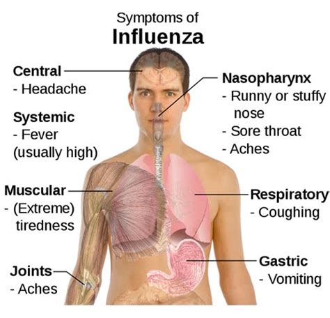 Influenza Virus Symptoms