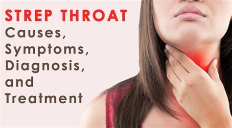 Strep Throat: Causes, Symptoms, Diagnosis, and Treatment.