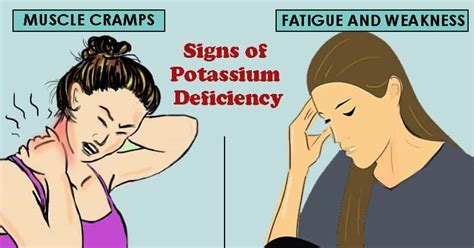 5 Signs of Potassium Deficiency or Hypokalemia That You Shouldn't ...