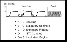 normal end tidal co2 range - Good Inside Forum Slideshow