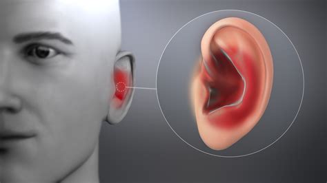 Ear Infection: Symptoms, Causes, and Treatment - Scientific Animations