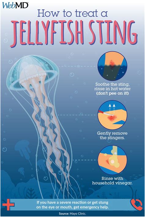 Does Vinegar Really Work For Jellyfish Stings? Discover The Truth!