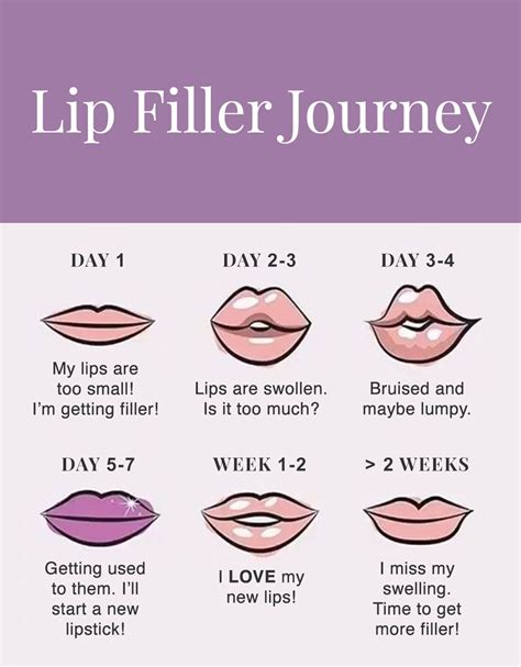 Lip flip vs lip filler – Artofit