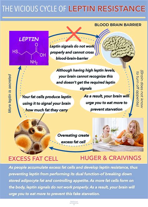 Leptin Resistance Symptoms; Leptin Resistance Medication & Treatment | FindBMI.net