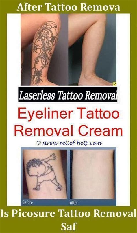 Best Tattoo Removal Near Me - NEARSA