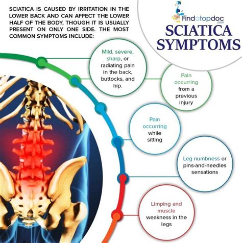 What are the symptoms of Sciatica? Facts about Sciatica [Infographic]