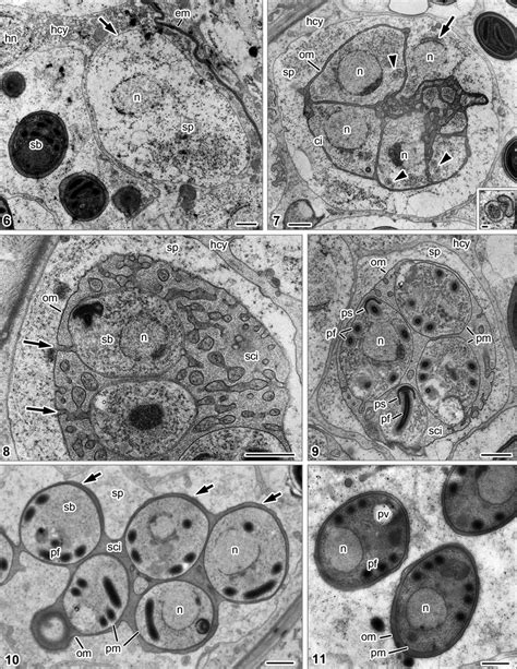 Sporogony. ci – cistern, em – extracellular matrix supporting... | Download Scientific Diagram