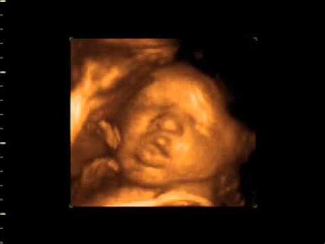 4D Ultrasound of 34 Week Baby - YouTube