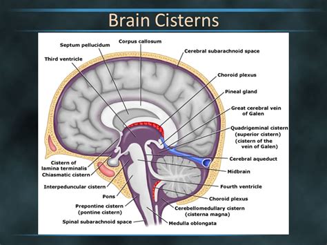 Cisterns Anatomy - Anatomical Charts & Posters