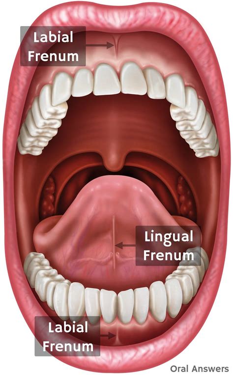 What a Frenectomy is and Why Your Child Might Need One | Mouth health ...