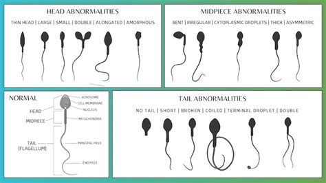 sperm morphology | Cryobank America