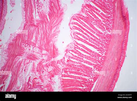 Lumbricus, transverse section through Typhlosole Stock Photo - Alamy