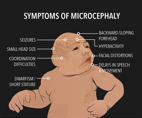 What Are Common Symptoms of Phenylketonuria (PKU)? - StoryMD