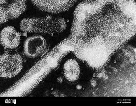 medicine, disease, influenza, Hong Kong Flu, 1968 - 1969, the virus ...