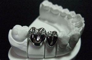 Stainless Steel Dental Crown | News | Dentagama