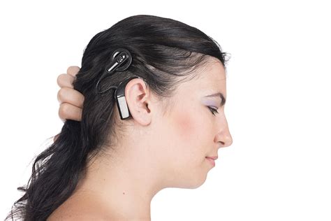 Cochlear implants may be losing their awkward external hardware