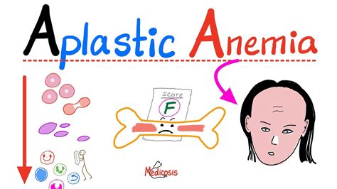 Aplastic Anemia - All you need to know - Definition, Causes, Symptoms ...