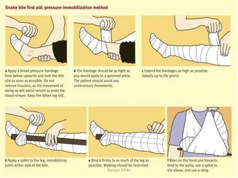 Snake bite,first aid, anti-venom treatment and ward management