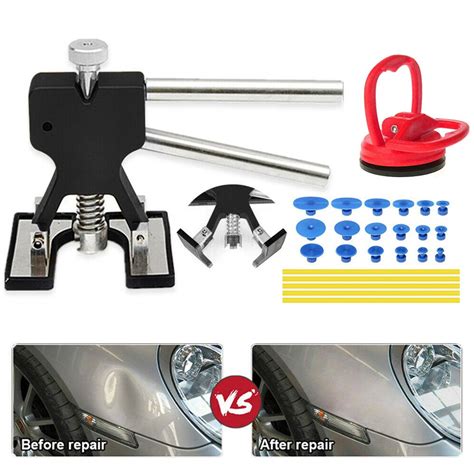 Dent Puller Kit Paintless Dent Removal Tool Dent Lifter DIY Dent Repair Set Hail Removal Kit ...