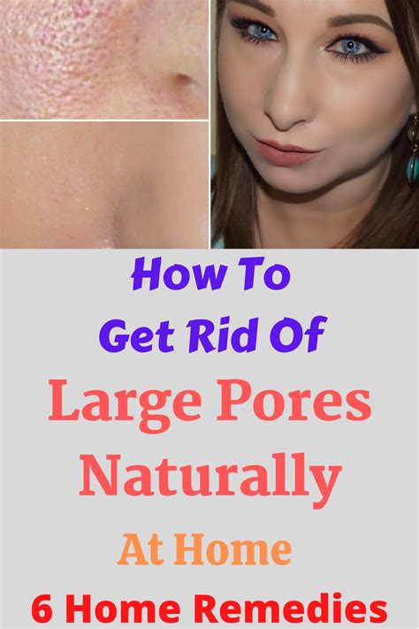 How To Get Rid Of Large Pores Naturally At Home - 6 Home Remedies ~ WEDDING AND WOMEN LIFE