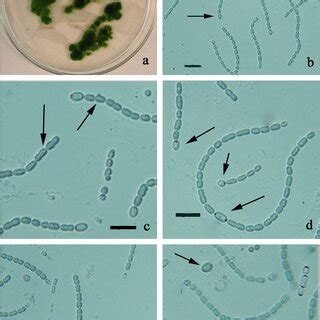 Life cycle of Desmonostoc alborizicum: a Hormogonia, b, c, d Heterocyte... | Download Scientific ...