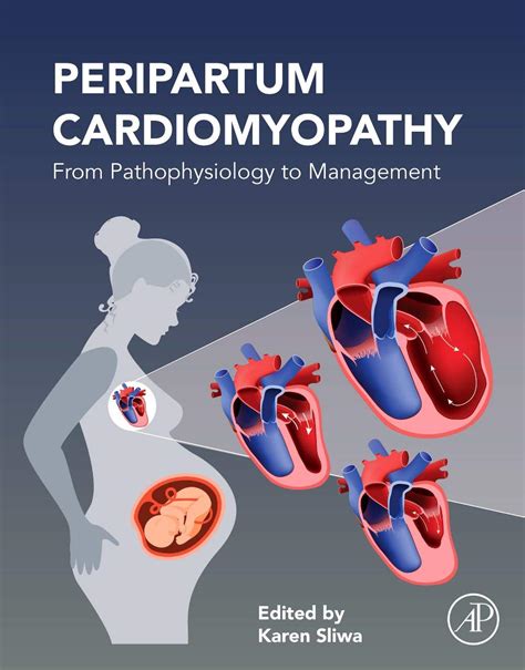 Peripartum Cardiomyopathy: From Pathophysiology to Management - SoftArchive