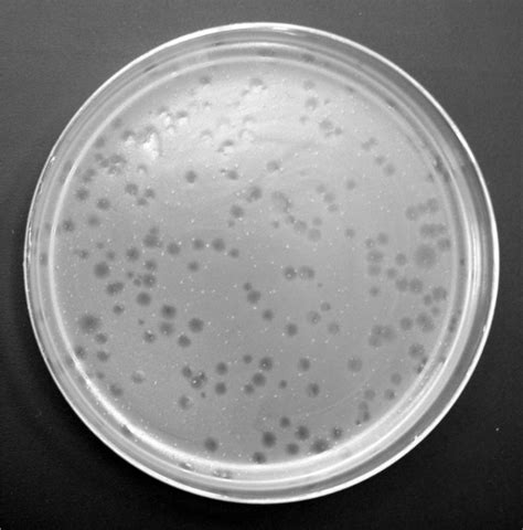 Plaque Assay: Phage Enumeration in Environmental Samples | Environmental Microbiology | JoVE