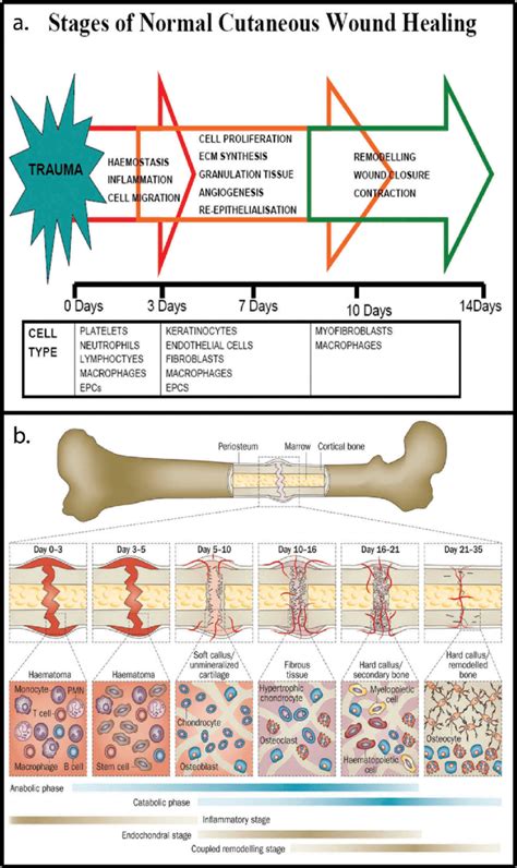 Stage Of Bone Healing - slideshare