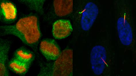 Centrosomes and Cilia